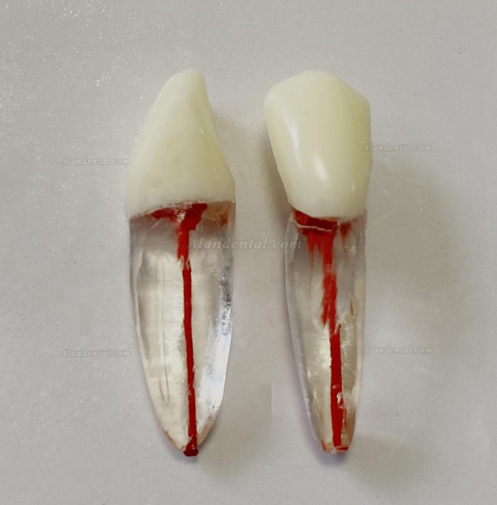 Dental Teeth Model Endo Files Practise Molar Upper Lower Tooth Premolar Root 2/3-Rooted Canal